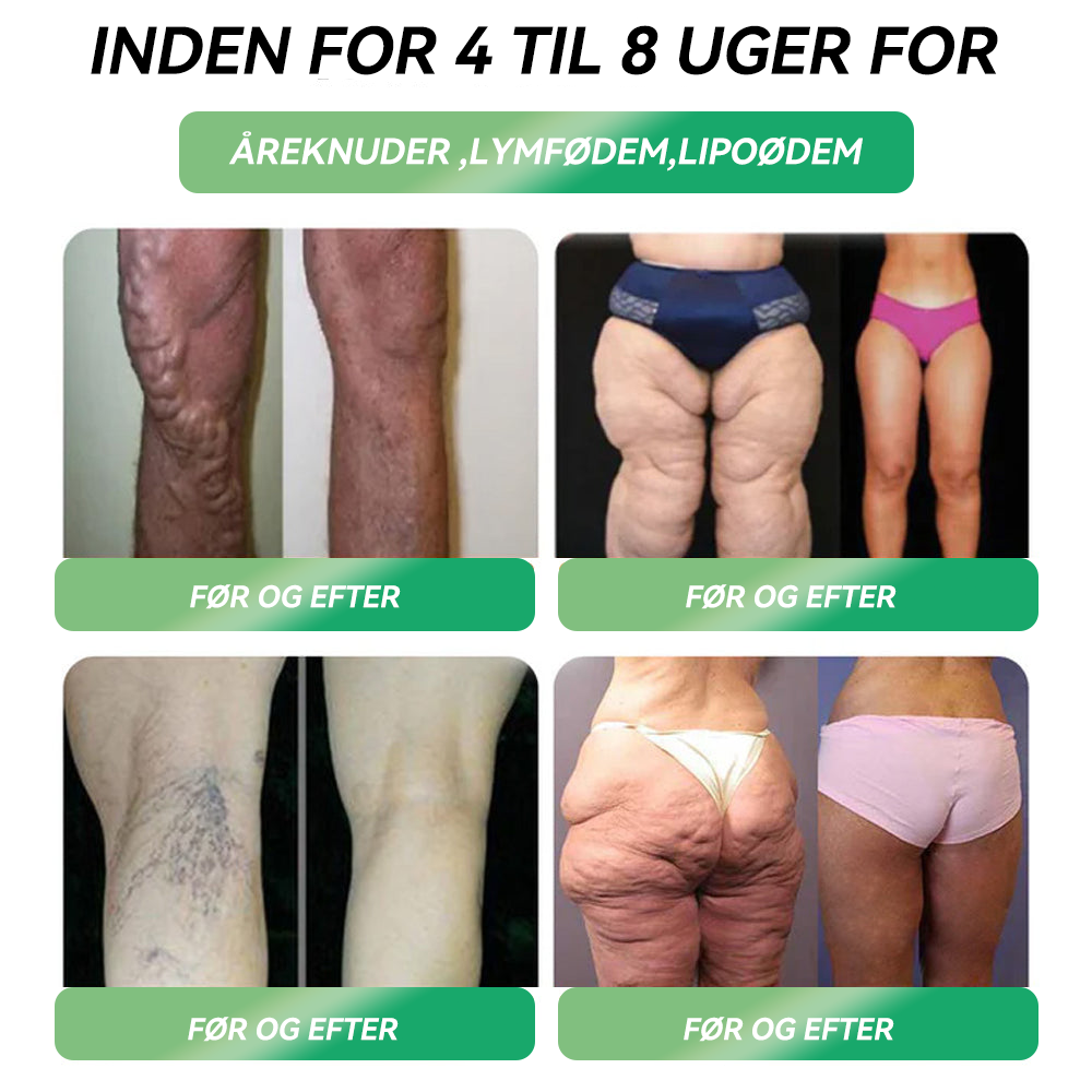 𝐎𝐟𝐟𝐢𝐜𝐢𝐞𝐥 𝐛𝐮𝐭𝐢𝐤 | 𝐇𝐇𝐕𝐁® ⏰⏰𝐆𝐋𝐏-𝟏 𝐒𝐈𝐗-𝐈𝐍-𝐎𝐍𝐄 𝐒𝐮𝐧𝐝𝐡𝐞𝐝𝐬𝐥ø𝐬𝐧𝐢𝐧𝐠 𝐎𝐫𝐚𝐥 𝐕æ𝐬𝐤𝐞 (𝐊𝐮𝐧 é𝐧 𝐠𝐚𝐧𝐠 𝐨𝐦 𝐝𝐚𝐠𝐞𝐧, 𝐬𝐲𝐧𝐥𝐢𝐠𝐞 𝐫𝐞𝐬𝐮𝐥𝐭𝐚𝐭𝐞𝐫 𝐩å 𝟕 𝐝𝐚𝐠𝐞) ✅ 𝐓𝐢𝐥 𝐟𝐞𝐝𝐦𝐞, 𝐡𝐣𝐞𝐫𝐭𝐞-𝐤𝐚𝐫-𝐬𝐮𝐧𝐝𝐡𝐞𝐝, 𝐝𝐢𝐚𝐛𝐞𝐭𝐞𝐬, 𝐬ø𝐯𝐧𝐚𝐩𝐧ø, 𝐭𝐚𝐫𝐦𝐡𝐞𝐥𝐛𝐫𝐞𝐝, 𝐥𝐞𝐝𝐬𝐦𝐞𝐫𝐭𝐞𝐫 𝐨𝐠 𝐦𝐞𝐠𝐞𝐭 𝐦𝐞𝐫𝐞🎁