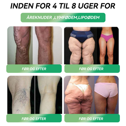 𝐎𝐟𝐟𝐢𝐜𝐢𝐞𝐥 𝐛𝐮𝐭𝐢𝐤 | 𝐇𝐇𝐕𝐁® ⏰⏰𝐆𝐋𝐏-𝟏 𝐒𝐈𝐗-𝐈𝐍-𝐎𝐍𝐄 𝐒𝐮𝐧𝐝𝐡𝐞𝐝𝐬𝐥ø𝐬𝐧𝐢𝐧𝐠 𝐎𝐫𝐚𝐥 𝐕æ𝐬𝐤𝐞 (𝐊𝐮𝐧 é𝐧 𝐠𝐚𝐧𝐠 𝐨𝐦 𝐝𝐚𝐠𝐞𝐧, 𝐬𝐲𝐧𝐥𝐢𝐠𝐞 𝐫𝐞𝐬𝐮𝐥𝐭𝐚𝐭𝐞𝐫 𝐩å 𝟕 𝐝𝐚𝐠𝐞) ✅ 𝐓𝐢𝐥 𝐟𝐞𝐝𝐦𝐞, 𝐡𝐣𝐞𝐫𝐭𝐞-𝐤𝐚𝐫-𝐬𝐮𝐧𝐝𝐡𝐞𝐝, 𝐝𝐢𝐚𝐛𝐞𝐭𝐞𝐬, 𝐬ø𝐯𝐧𝐚𝐩𝐧ø, 𝐭𝐚𝐫𝐦𝐡𝐞𝐥𝐛𝐫𝐞𝐝, 𝐥𝐞𝐝𝐬𝐦𝐞𝐫𝐭𝐞𝐫 𝐨𝐠 𝐦𝐞𝐠𝐞𝐭 𝐦𝐞𝐫𝐞🎁